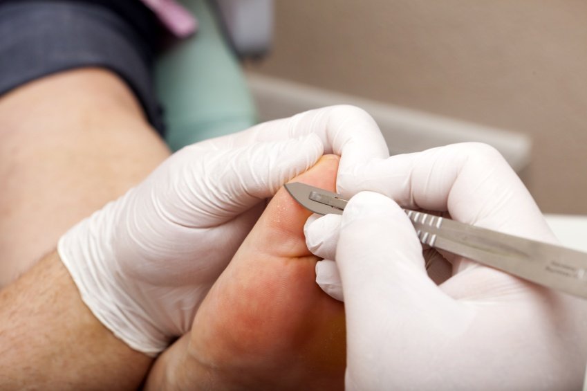 дерматолог берет соскоб с кожи на приеме