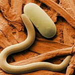 <b>Некоторые болезни планируют лечить червями-паразитами</b>