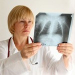 <b>Эксперты рассказали, как отличить кашель при простуде от рака</b>